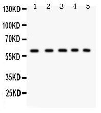 STK11 / LKB1 Antibody - LKB1 antibody Western blot. All lanes: Anti LKB1 at 0.5 ug/ml. Lane 1: 293T Whole Cell Lysate at 40 ug. Lane 2: HT1080 Whole Cell Lysate at 40 ug. Lane 3: SHG Whole Cell Lysate at 40 ug. Lane 4: JURKAT Whole Cell Lysate at 40 ug. Lane 5: Human Placenta Tissue Lysate at 50 ug. Predicted band size: 48 kD. Observed band size: 60 kD.