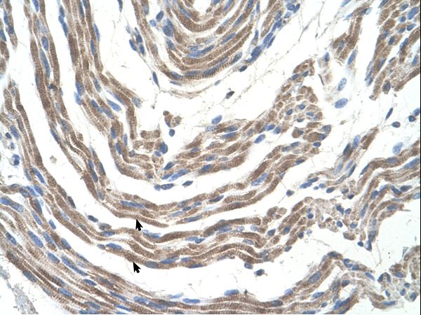 STK11 / LKB1 Antibody - STK11 / LKB1 antibody ARP41743_T100-NP_000446-STK11(serine/threonine kinase 11) Antibody was used in IHC to stain formalin-fixed, paraffin-embedded human muscle.  This image was taken for the unconjugated form of this product. Other forms have not been tested.