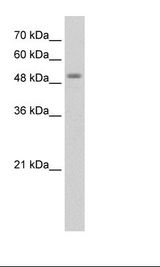 STK11 / LKB1 Antibody - Jurkat Cell Lysate.  This image was taken for the unconjugated form of this product. Other forms have not been tested.