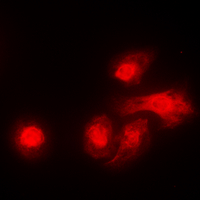 STK11 / LKB1 Antibody - Immunofluorescent analysis of LKB1 staining in A431 cells. Formalin-fixed cells were permeabilized with 0.1% Triton X-100 in TBS for 5-10 minutes and blocked with 3% BSA-PBS for 30 minutes at room temperature. Cells were probed with the primary antibody in 3% BSA-PBS and incubated overnight at 4 C in a humidified chamber. Cells were washed with PBST and incubated with a DyLight 594-conjugated secondary antibody (red) in PBS at room temperature in the dark. DAPI was used to stain the cell nuclei (blue).