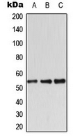 STK11 / LKB1 Antibody - Western blot analysis of LKB1 expression in Jurkat (A); K562 (B); NIH3T3 (C) whole cell lysates.