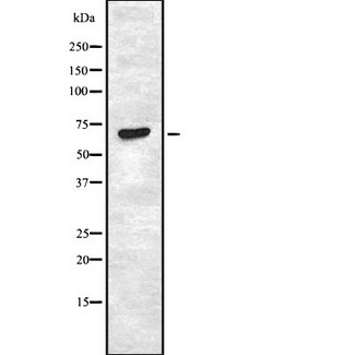 STK11 / LKB1 Antibody - Western blot analysis of human lung carcinoma tissue using LKB1 antibody.