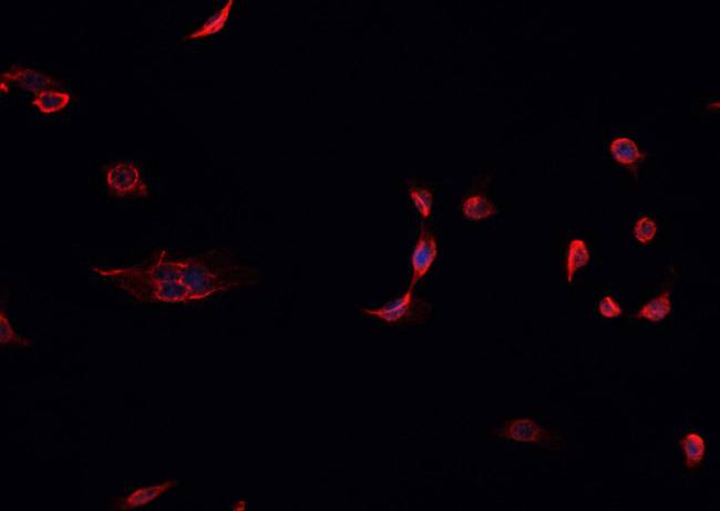STK11 / LKB1 Antibody - Staining HeLa cells by IF/ICC. The samples were fixed with PFA and permeabilized in 0.1% Triton X-100, then blocked in 10% serum for 45 min at 25°C. The primary antibody was diluted at 1:200 and incubated with the sample for 1 hour at 37°C. An Alexa Fluor 594 conjugated goat anti-rabbit IgG (H+L) Ab, diluted at 1/600, was used as the secondary antibody.