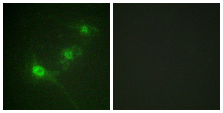 STK11 / LKB1 Antibody - Immunofluorescence analysis of NIH/3T3 cells, using LKB1 (Phospho-Ser428) Antibody. The picture on the right is blocked with the phospho peptide.