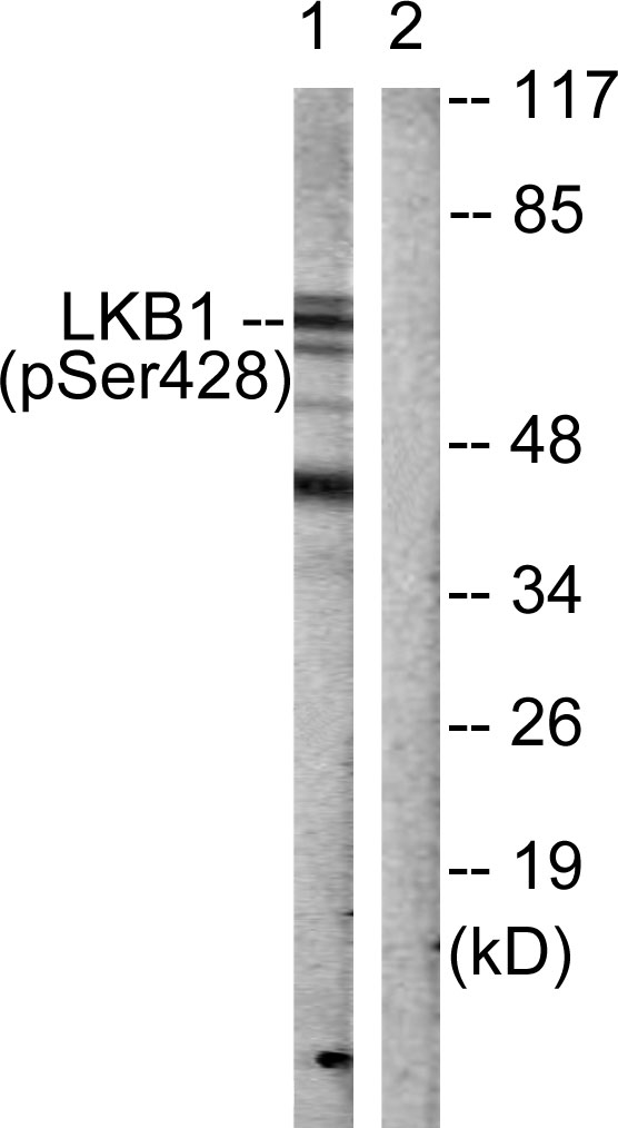 STK11 / LKB1 Antibody - Western blot analysis of lysates from HeLa cells treated with PMA 125ng/ml 30', using LKB1 (Phospho-Ser428) Antibody. The lane on the right is blocked with the phospho peptide.