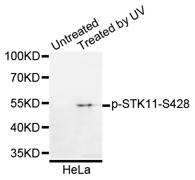 STK11 / LKB1 Antibody - Western blot analysis of extracts of HeLa cells.