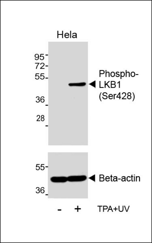 STK11 / LKB1 Antibody - Western blot analysis of lysates from Hela cell line, untreated or treated with TPA, 200nM and UV, using (upper) or Beta-actin (lower).