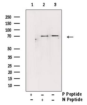 STK11 / LKB1 Antibody - Western blot analysis of Phospho-LKB1 (Ser428) antibody expression in PMA treated HeLa cells lysates. The lane on the right is treated with the antigen-specific peptide.