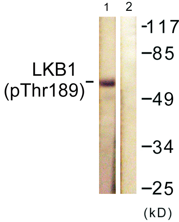 STK11 / LKB1 Antibody - Western blot analysis of lysates from NIH/3T3 cells treated with PMA 125ng/ml 30', using LKB1 (Phospho-Thr189) Antibody. The lane on the right is blocked with the phospho peptide.
