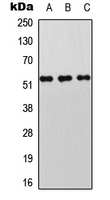 STK11 / LKB1 Antibody - Western blot analysis of LKB1 (pT189) expression in A431 (A); Jurkat (B); NIH3T3 (C) whole cell lysates.