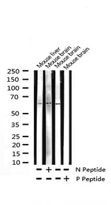 STK11 / LKB1 Antibody - Western blot analysis of Phospho-LKB1 (Thr189) expression in various lysates