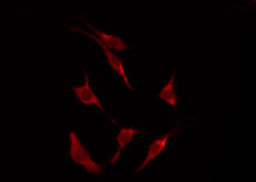 STK11 / LKB1 Antibody - Staining HeLa cells by IF/ICC. The samples were fixed with PFA and permeabilized in 0.1% Triton X-100, then blocked in 10% serum for 45 min at 25°C. The primary antibody was diluted at 1:200 and incubated with the sample for 1 hour at 37°C. An Alexa Fluor 594 conjugated goat anti-rabbit IgG (H+L) Ab, diluted at 1/600, was used as the secondary antibody.