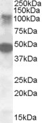 STK11IP Antibody - STK11IP antibody (0.5 ug/ml) staining of Human Ovary lysate (35 ug protein/ml in RIPA buffer). Primary incubation was 1 hour. Detected by chemiluminescence.