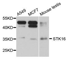 STK16 Antibody - Western blot analysis of extract of various cells.