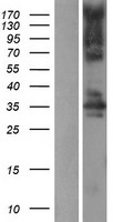 STK16 Protein - Western validation with an anti-DDK antibody * L: Control HEK293 lysate R: Over-expression lysate