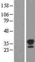 STK16 Protein - Western validation with an anti-DDK antibody * L: Control HEK293 lysate R: Over-expression lysate