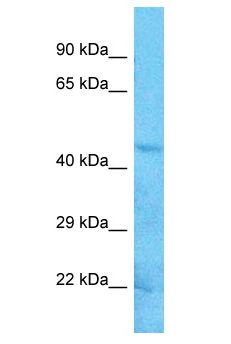 STK17B / DRAK2 Antibody - STK17B / DRAK2 antibody Western Blot of A549. Antibody dilution: 3 ug/ml.  This image was taken for the unconjugated form of this product. Other forms have not been tested.