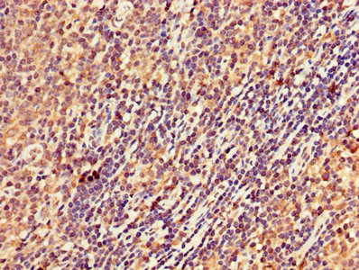 STK17B / DRAK2 Antibody - IHC image of STK17B Antibody diluted at 1:300 and staining in paraffin-embedded human lymph node tissue performed on a Leica BondTM system. After dewaxing and hydration, antigen retrieval was mediated by high pressure in a citrate buffer (pH 6.0). Section was blocked with 10% normal goat serum 30min at RT. Then primary antibody (1% BSA) was incubated at 4°C overnight. The primary is detected by a biotinylated secondary antibody and visualized using an HRP conjugated SP system.