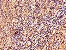 STK17B / DRAK2 Antibody - IHC image of STK17B Antibody diluted at 1:300 and staining in paraffin-embedded human lymph node tissue performed on a Leica BondTM system. After dewaxing and hydration, antigen retrieval was mediated by high pressure in a citrate buffer (pH 6.0). Section was blocked with 10% normal goat serum 30min at RT. Then primary antibody (1% BSA) was incubated at 4°C overnight. The primary is detected by a biotinylated secondary antibody and visualized using an HRP conjugated SP system.