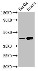 STK17B / DRAK2 Antibody - Western Blot Positive WB detected in: HepG2 whole cell lysate, Mouse brain tissue All lanes: STK17B antibody at 3µg/ml Secondary Goat polyclonal to rabbit IgG at 1/50000 dilution Predicted band size: 43 kDa Observed band size: 43 kDa