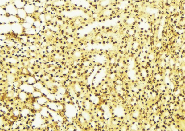 STK17B / DRAK2 Antibody - 1:100 staining mouse liver tissue by IHC-P. The sample was formaldehyde fixed and a heat mediated antigen retrieval step in citrate buffer was performed. The sample was then blocked and incubated with the antibody for 1.5 hours at 22°C. An HRP conjugated goat anti-rabbit antibody was used as the secondary.