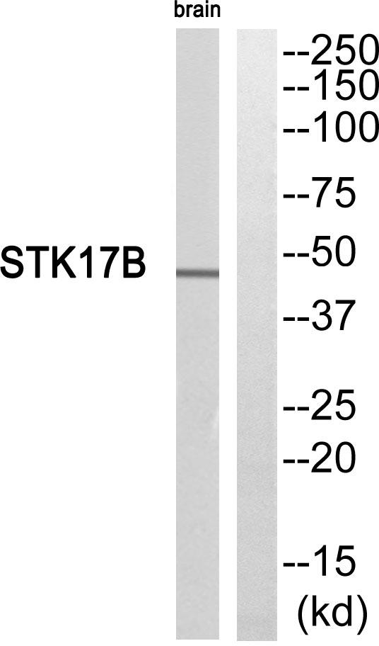 STK17B / DRAK2 Antibody - Western blot analysis of extracts from mouse brain cells, using STK17B antibody.