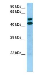 STK19 Antibody - STK19 antibody Western Blot of 293T.  This image was taken for the unconjugated form of this product. Other forms have not been tested.