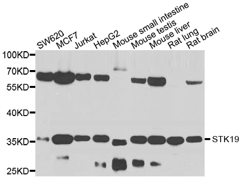 STK19 Antibody - Western blot analysis of extracts of various cell lines.