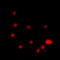 STK19 Antibody - Immunofluorescent analysis of STK19 staining in A549 cells. Formalin-fixed cells were permeabilized with 0.1% Triton X-100 in TBS for 5-10 minutes and blocked with 3% BSA-PBS for 30 minutes at room temperature. Cells were probed with the primary antibody in 3% BSA-PBS and incubated overnight at 4 deg C in a humidified chamber. Cells were washed with PBST and incubated with a DyLight 594-conjugated secondary antibody (red) in PBS at room temperature in the dark.