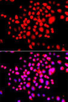 STK19 Antibody - Immunofluorescence analysis of A549 cells using STK19 antibody. Blue: DAPI for nuclear staining.