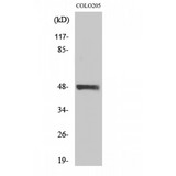 STK24 / MST3 Antibody - Western blot of MST-3 antibody