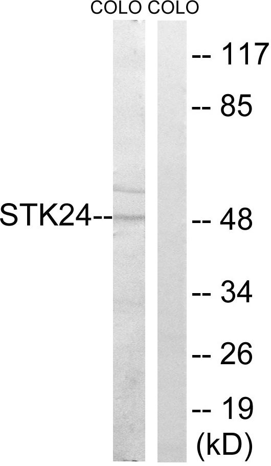 STK24 / MST3 Antibody - Western blot analysis of lysates from COLO cells, using STK24 Antibody. The lane on the right is blocked with the synthesized peptide.