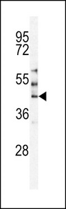 STK24 / MST3 Antibody - Western blot of MST3 Antibody in HepG2 cell line lysates (35 ug/lane). MST3 (arrow) was detected using the purified antibody.