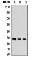 STK24 / MST3 Antibody - Western blot analysis of MST3 expression in HepG2 (A); PC3 (B); mouse brain (C) whole cell lysates.