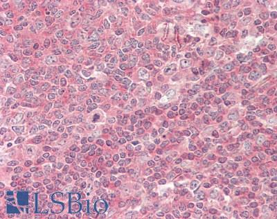 STK24 / MST3 Antibody - Human Tonsil: Formalin-Fixed, Paraffin-Embedded (FFPE).  This image was taken for the unconjugated form of this product. Other forms have not been tested.