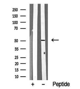 STK24 / MST3 Antibody - Western blot analysis of MST3 in lysates of HeLa cells using MST3 antibody.