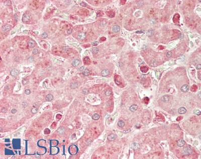 STK25 Antibody - Human Liver: Formalin-Fixed, Paraffin-Embedded (FFPE).  This image was taken for the unconjugated form of this product. Other forms have not been tested.