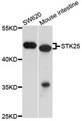 STK25 Antibody - Western blot analysis of extract of various cells.