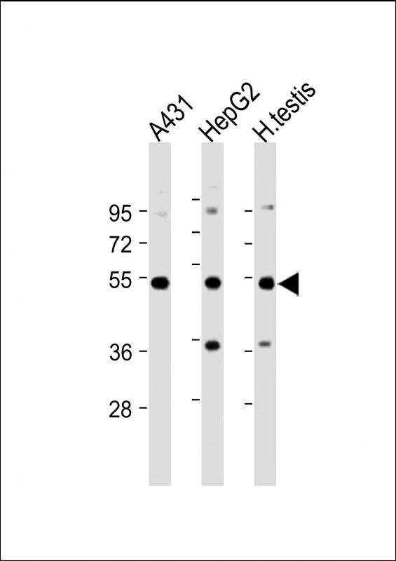 STK25 Antibody - All lanes: Anti-STK25 Antibody at 1:2000 dilution Lane 1: A431 whole cell lysate Lane 2: HepG2 whole cell lysate Lane 3: Human testis lysate Lysates/proteins at 20 µg per lane. Secondary Goat Anti-Rabbit IgG, (H+L), Peroxidase conjugated at 1/10000 dilution. Predicted band size: 48 kDa Blocking/Dilution buffer: 5% NFDM/TBST.