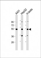 STK25 Antibody - All lanes: Anti-STK25 Antibody at 1:2000 dilution Lane 1: A431 whole cell lysate Lane 2: HepG2 whole cell lysate Lane 3: Human testis lysate Lysates/proteins at 20 µg per lane. Secondary Goat Anti-Rabbit IgG, (H+L), Peroxidase conjugated at 1/10000 dilution. Predicted band size: 48 kDa Blocking/Dilution buffer: 5% NFDM/TBST.