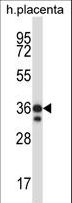 STK26 / MST4 Antibody - Mouse Mst4 Antibody western blot of human placenta tissue lysates (35 ug/lane). The Mst4 antibody detected the Mst4 protein (arrow).