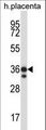 STK26 / MST4 Antibody - Mouse Mst4 Antibody western blot of human placenta tissue lysates (35 ug/lane). The Mst4 antibody detected the Mst4 protein (arrow).