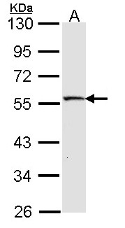 STK26 / MST4 Antibody - Sample (30 ug of whole cell lysate). A: IMR32 10% SDS PAGE. MST4 antibody diluted at 1:1000.