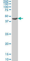 STK26 / MST4 Antibody - RP6-213H19 1 monoclonal antibody (M03), clone 3G5 Western blot of RP6-213H19 1 expression in HL-60.