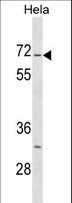 STK3 Antibody - Mouse Stk3 Antibody western blot of HeLa cell line lysates (35 ug/lane). The Stk3 antibody detected the Stk3 protein (arrow).