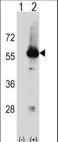 STK3 Antibody - Western blot of Stk3 (arrow) using rabbit polyclonal Mouse Stk3 Antibody. 293 cell lysates (2 ug/lane) either nontransfected (Lane 1) or transiently transfected (Lane 2) with the Stk3 gene.