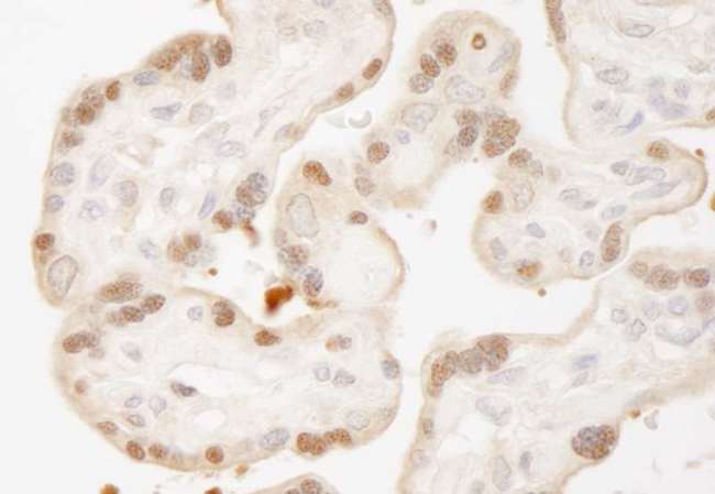 STK3 Antibody - Detection of Human MST1,2/STK3,4 by Immunohistochemistry. Sample: FFPE section of human placenta. Antibody: Affinity purified rabbit anti-MST1,2/STK3,4 used at a dilution of 1:250.