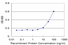 STK3 Antibody - Detection limit for recombinant GST tagged STK3 is approximately 3 ng/ml as a capture antibody.