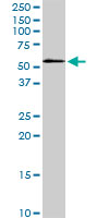 STK3 Antibody - STK3 monoclonal antibody (M13), clone 4F7. Western blot of STK3 expression in HepG2.
