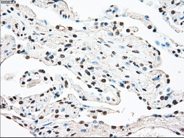 STK3 Antibody - IHC of paraffin-embedded lung tissue using anti-STK3 mouse monoclonal antibody. (Dilution 1:50).
